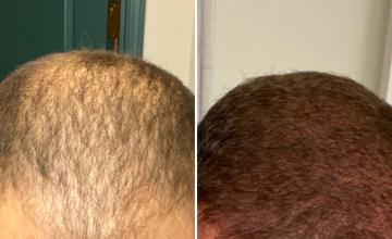 Before and After 