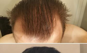 Before and After 