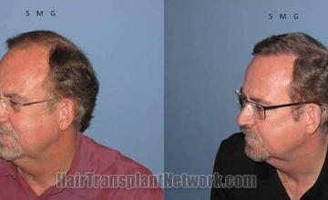 Before and after  photos